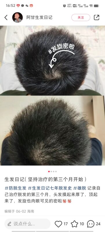 张猛 小红书 打卡  第四天 -流量情报局-嗨推旗下流量情报局